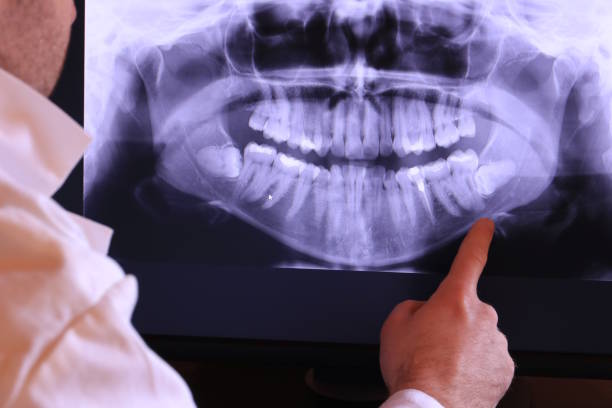 Best Emergency Treatment for Toothache in Dasher, GA